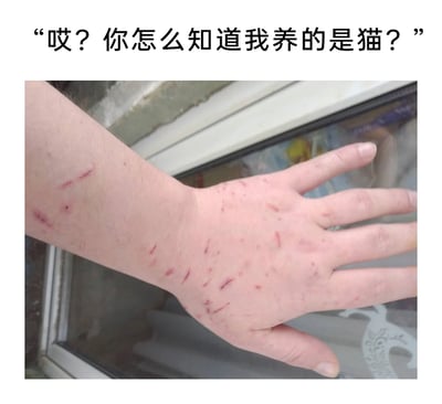 这是一张充满共鸣感的养猫主题梗图，图片上方配有文字“哎？你怎么知道我养的是猫？”，下方是一只真实的人手及小臂，皮肤上布满了密集的、深浅不一的细长红色抓痕，这些都是猫咪抓挠留下的痕迹。图中用直观的身体伤痕来呼应配文，调侃养猫人群常常会被自家猫咪抓挠，这些伤痕成为了“养猫”的标志性证明，既搞笑又能让养猫的网友感同身受，精准戳中养猫日常里的小无奈与趣味。