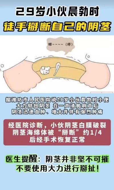 这是一则男性健康科普图文，内容基于潍坊市人民医院的真实病例：一名29岁小伙在晨勃时小便，大力掰扭阴茎，导致阴茎白膜破裂、海绵体被“掰断”约1/4，随即出现阴茎血肿、增大、强烈肿痛的症状，后经手术恢复正常。图文配有卡通示意图展示受伤情况，最后医生发出提醒，告知阴茎并非坚不可摧，切勿大力掰扯生殖器官，以此向大众传递生殖健康保护的知识，无谐音梗、双关或暗示内容。