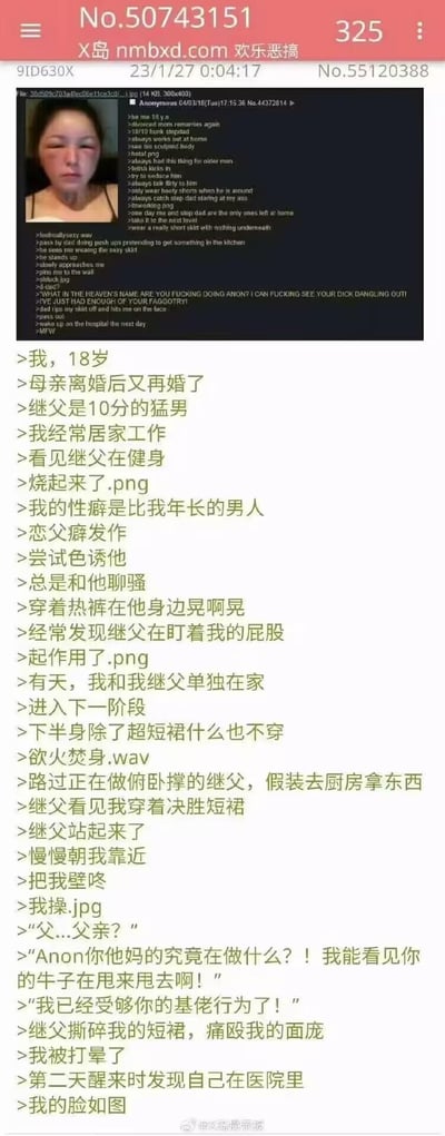 这是一个汉化改编的国外匿名论坛帖子梗图，讲述18岁的主角在母亲再婚拥有猛男继父后，因恋父癖发作，通过穿热裤、聊骚等方式色诱继父，误以为继父被自己吸引，结果在两人单独在家时进一步色诱，却被继父发现自己是男性（从台词“牛子甩来甩去”得知），最终被继父暴打进医院，配图是被打肿脸的人。整个故事以性别反转制造强烈反差，属于荒诞搞笑的重口梗图，利用匿名论坛的离谱自爆风格带来笑点。