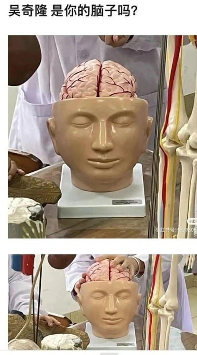 这是一组上下对比的搞笑梗图，图中是一个脸部撞脸明星吴奇隆的解剖教学头部模型，上图配文“吴奇隆 是你的脑子吗？”，下图展示有人正将模型的脑壳部分拿起，仿佛在“掀开吴奇隆的脑子”，利用模型与明星撞脸的巧合制造出荒诞搞笑的效果，调侃模型的脸部与吴奇隆高度相似。