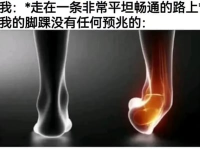 图片上方配有文字“我: *走在一条非常平坦畅通的路上* 我的脚踝没有任何预兆的:”，下方是两张脚踝的对比图像。左侧脚踝呈现正常的灰白色透明骨骼效果，右侧脚踝则有明显的红色和橙色高亮区域，模拟出突然疼痛的视觉效果。整体通过文字与医学风格图像的结合，幽默地表现了在平坦道路上行走时脚踝毫无预兆突然疼痛的日常经历，容易引发人们对类似意外身体状况的共鸣。