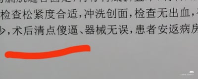这是一张医疗手术记录文本的局部截图，内容是手术收尾阶段的记录，原本规范表述应为“术后清点纱布、器械无误”，但因输入法拼音联想错误，将“纱布”误写为脏话“傻逼”，出错的内容下方用红色曲线标注了出来，是因打字失误产生的搞笑梗。