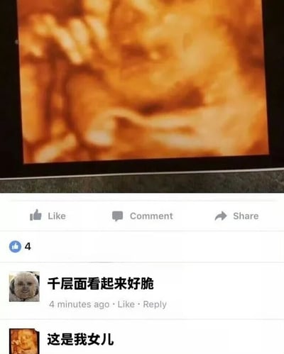 社交媒体截图，上方显示一张胎儿超声波图像，下方是评论区互动。第一条评论将医学影像误认成食物，评论'千层面看起来好脆'，随后原作者回复'这是我女儿'，形成因视觉相似性导致的幽默误解效果。