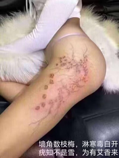 图片展示了一个人的腿部，膝盖及小腿部位有明显的皮肤痕迹，呈现出类似抓痕、淤青或皮疹的红色印记和斑点。腿部上方有白色的毛绒物体，可能是宠物或毛毯。图片底部配有改编自王安石《梅花》的诗句："墙角数枝梅，淋寒毒自开 疣知不是雪，为有艾香来"，通过谐音和字形替换制造幽默效果，将原诗中描写梅花不畏严寒的意境扭曲为与皮肤问题相关的调侃内容。