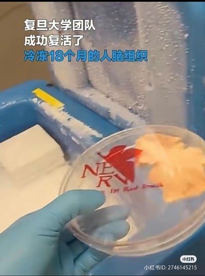 这是一张结合科研新闻与ACG玩梗的二次创作图，画面上方配文宣称“复旦大学团队成功复活了冷冻18个月的人脑组织”，画面主体是一只戴着蓝色实验手套的手，拿着装有类似脑组织样本的培养皿，背景是带有冰霜的低温设备。但培养皿上被P上了《新世纪福音战士》（EVA）中虚构组织NERV的标志，将现实科研内容与科幻作品元素结合，制造出趣味反差感，属于玩梗创作。