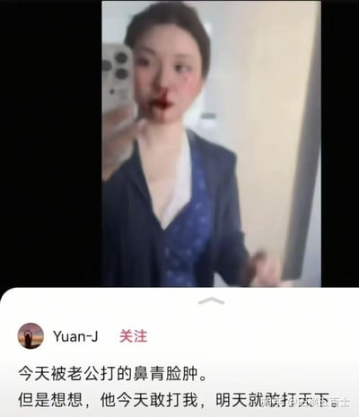 图片显示一名女子在镜子前自拍，面部有明显伤痕，包括嘴唇出血和眼部周围淤青。她穿着深色外套，内搭白色衣物，正在用手机拍摄自己。图片下方是社交媒体帖子文字："今天被老公打的鼻青脸肿。但是想想，他今天敢打我，明天就"，文字似乎被截断。