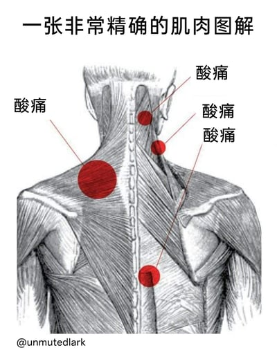 这是一张以人体颈肩部位肌肉解剖线稿为基础创作的趣味图，标题为'一张非常精确的肌肉图解'。图中用大小不一的红色圆点精准标注出了颈肩区域四个典型的酸痛位置，每个位置都配有'酸痛'的文字说明，生动且幽默地展现了长期伏案工作的人群普遍存在的颈肩劳损问题，精准戳中打工人的身体不适痛点，容易引发共鸣。