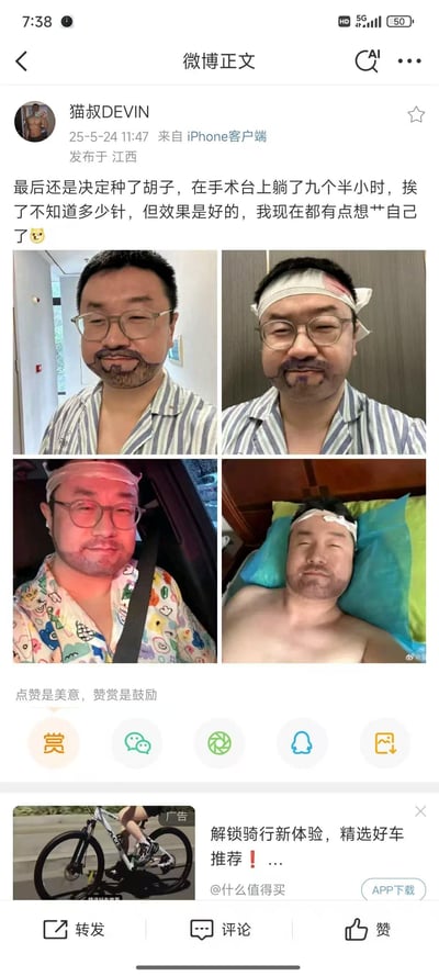 微博用户@猫叔DEVIN发布动态，分享自己进行胡须种植手术的经历：在手术台耗时九个半小时，挨了大量针剂，术后效果让自己十分满意，甚至调侃自己“想艹自己”。配图为四张实拍图，依次展示了术前画好胡须种植区域的状态、术后头部包扎的样子、术后乘车的状态、术后躺着休息的状态，完整呈现了从术前准备到术后恢复的过程。