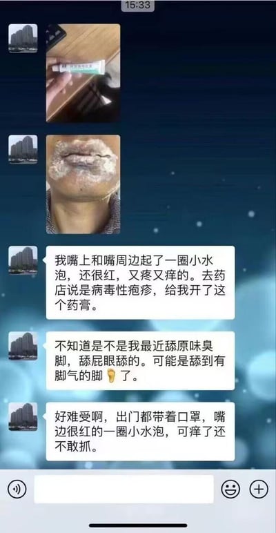 这是一张聊天记录截图，展示了某人嘴上和嘴周边长了一圈小水泡的情况。图片中包含两张照片：一张是药膏的特写，另一张是嘴部疱疹的特写。聊天内容描述了症状（又疼又痒、红肿）、就医结果（病毒性疱疹）以及对病因的猜测（可能与舔脚气脚等不良卫生习惯有关），最后表达了难受和出门需戴口罩的困扰。