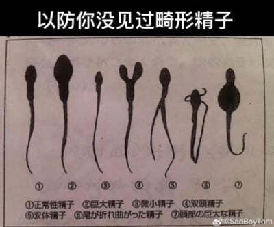 这是一张生殖健康科普类的图文示意图，顶部配有醒目标题“以防你没见过畸形精子”。图中展示了7种不同形态的精子，从左到右依次标注：①正常性精子、②巨大精子、③微小精子、④双头精子、⑤双体精子、⑥尾部弯曲折叠的精子、⑦头部巨大的精子，标注采用中日双语呈现（中文为简体说明，日文为对应形态描述）。该图通过直观的绘图对比，清晰展示了正常精子与各类形态异常的精子的外观差异，用于向大众科普生殖健康相关知识，图中不存在双关、谐音梗或暗示类内容。