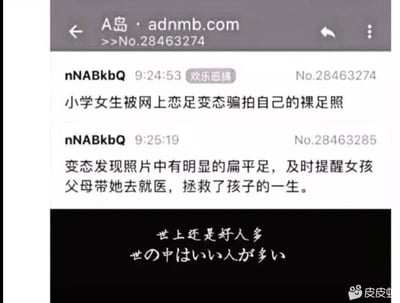 这是一张网络搞笑梗图，内容源自A岛的帖子，采用反转叙事的方式制造笑点：先是描述小学女生被网上恋足者骗拍裸足照，紧接着剧情反转，恋足者从照片里发现女孩存在明显扁平足，随即提醒女孩父母带她就医，称这一行为拯救了孩子的一生。图的底部配有中日文对照的配文“世上还是好人多 世の中はいい人が多い”，进一步强化这种反差感带来的荒诞搞笑效果，图的右下角带有皮皮虾平台的水印。