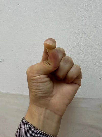 这是一张竖版的原始拍摄静态照片，画面主体是一只成年人的手，背景为素净的浅灰色墙面。这只手做出了利用视觉错位的特殊握拳姿势：食指弯曲后叠放在中指上方，从当前拍摄角度看，仿佛食指的指节与中指部分融合，形成了形态怪异的“畸形手指”，制造出有趣的视觉错觉效果。手部皮肤带有自然的纹理，手腕处露出带有细格纹的衣袖，整体画面构图清晰，没有多余元素，核心看点就是这个巧妙的视觉错位设计。