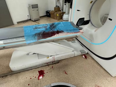 这是一张医院放射科CT检查室的实拍图，画面右侧是一台带有蓝色装饰灯光的CT扫描设备，左侧的检查床上铺着的蓝色一次性垫单沾染了大片深色血迹，血迹渗透并附着在床体边缘，地面上也散落着几处血渍和凝血块，场景看起来是重伤患者在此接受检查后留下的，整体氛围紧张且沉重。