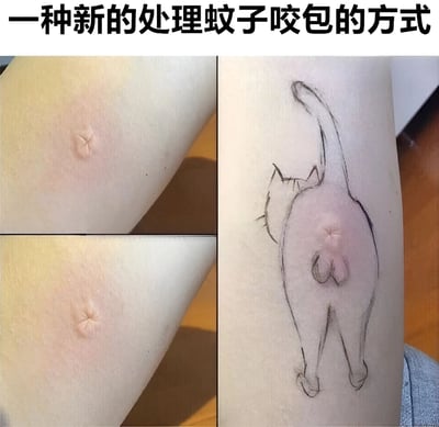 图片分为左右两部分，左侧展示了皮肤上的蚊子咬包，右侧则在咬包的基础上用黑色线条绘制了一只猫的背影，咬包恰好成为了猫的臀部，形成一种幽默的创意处理方式。