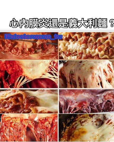 这张梗图通过九宫格的形式展示了心内膜炎的医学图像与意大利面的食物照片之间的视觉相似性，引发幽默效果。图片上方配有标题"心内膜炎還是義大利麵？"，让观众难以分辨哪张是医学图像，哪张是食物照片。