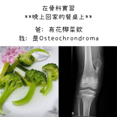 图片上方为文字描述场景：'在骨科实习 **晚上回家的餐桌上**'，接着是对话内容'爸：有花椰菜欸'和'我：是Osteochondroma'。下方左侧是一盘绿色的花椰菜（西兰花）实物图，右侧是一张膝关节X光片，显示出骨软骨瘤（Osteochondroma）的影像特征。通过将日常食材花椰菜的形状与骨科疾病骨软骨瘤的X光影像进行视觉关联，幽默地表现了骨科实习生因长期接触医学影像而产生的职业思维惯性，看到花椰菜也下意识联想到专业术语和病理影像。
