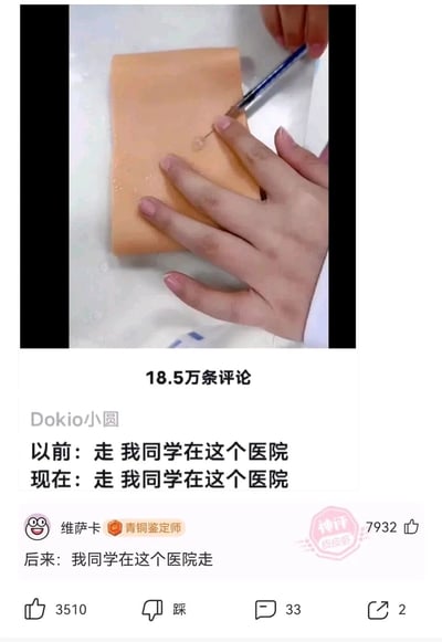 这是一张来自皮皮虾平台的社交媒体截图，画面上方是一名医学生正在使用模拟皮肤教具练习注射操作的场景；下方是该内容的评论区，显示共有18.5万条评论。用户“Dokio小圆”发布评论：“以前：走 我同学在这个医院 现在：走 我同学在这个医院”，用户“维萨卡”的评论通过改变断句，创作了“后来：我同学在这个医院走”的反转梗，夸张调侃医学生初期注射技术不熟练可能导致的“严重后果”，这条神评获得了7932个赞，制造出搞笑的反差效果，引发网友共鸣。