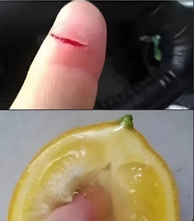 图片分为上下两部分。上半部分是特写镜头，展示了一根手指的指尖，上面有一道新鲜的小伤口，伤口处有少量血迹，周围皮肤泛红。下半部分同样是特写，展示了一片被切开的柠檬，柠檬黄色的果肉清晰可见，一只手指正在挤压柠檬，汁水似乎正要流出。这张图通过对比展示了日常生活中常见的小意外：切柠檬时不小心割伤手指，而柠檬的酸性汁液会进一步刺激伤口，带来刺痛感，引发观众共鸣。