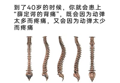 这是一张网络玩梗图，整体为纯白色背景，上方配有黑色中文文字，内容调侃人到四十岁会患上“薛定谔的背痛”，特点是动弹太多会疼痛，动弹太少同样也会疼痛，改编玩了量子力学经典思想实验“薛定谔的猫”的梗；文字下方水平排列了五张不同角度的人类脊柱骨骼示意图，呼应背痛与脊椎的主题，调侃了当代中年人普遍存在的背部健康困扰。