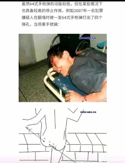 这是一张图文混排的搞笑军事梗图，上方配有文字说明“虽然64式手枪弹的动能较低，但在某些情况下也具备较高的停止作用，例如2007年一名犯罪嫌疑人在翻墙时被一发64式手枪弹打出了四个弹孔，当场束手就擒”；中间是一张真人照片，显示一名男子趴在带有蓝色垫子的金属架子上，面部扭曲、表情痛苦，呈现出受伤后的状态；下方是手绘的示意图，展示了嫌疑人翻墙时的姿势，子弹从一侧臀部射入、另一侧臀部射出，从而形成四个弹孔的原理，用夸张趣味的方式调侃64式手枪弹在特殊场景下的“特殊停止作用”。