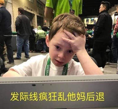 图片中是网络红人"假笑男孩"加文·托马斯，他正用手摸着额头，表情显得有些担忧和困扰。图片下方配有黄色文字："发际线疯狂乱他妈后退"，用幽默夸张的方式表达了对发际线后退的焦虑。这种将真实人物表情与网络流行话题结合的方式，形成了极具传播力的表情包。