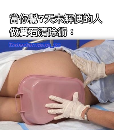 这张图片是一个医疗主题的搞笑梗图，上方配有文字"當你幫7天未解便的人做糞石清除術："。图片主体展示了一位躺在病床上的患者，腹部被暴露出来，一位戴着白色手套的医护人员正在进行操作，患者身下放置了一个粉色的塑料盆，暗示即将进行的粪石清除手术会产生大量物质。整个图片通过夸张的医疗场景来制造黑色幽默效果。