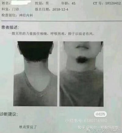 一张虚构的医疗报告截图，内容为一名45岁男性门诊患者的神经内科检查记录。患者描述称'一般无形的力量扼住喉咙，呼吸困难，脖子后面老有风'，并附有两张颈部照片（后颈和前颈）。报告底部的诊断建议却出乎意料：'秋衣穿反了'。图片通过夸张的患者症状与简单的诊断结果形成幽默对比，带有'小红书'和'知乎'平台的水印。
