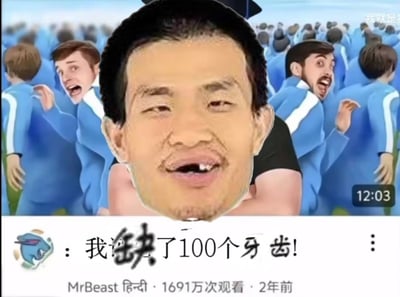 这是一张搞笑表情包，图片主体是一个表情夸张的人脸特写，背景是一群穿着蓝色制服、表情惊讶的动画人物。图片下方有一个蓝色兔子图标和文字“我缺了100个牙齿!”，以及“MrBeast 1691万次观看 · 2年前”的字样。整体风格幽默夸张，通过夸张的表情和文字制造笑点。