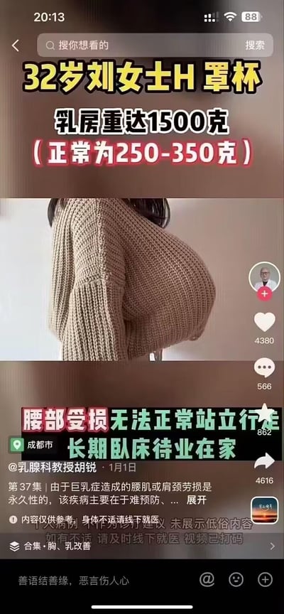 这是一张抖音医疗科普视频的截图，内容聚焦32岁刘女士的巨乳症病例：她的乳房达到H罩杯，单侧重达1500克，远超正常乳房250-350克的重量范围。过重的乳房给她带来了严重的身体负担，导致腰部受损，无法正常站立行走，只能长期卧床待业在家。视频由乳腺科教授胡锐发布，标注了「内容仅供参考，身体不适请线下就医」的提示，同时对人物进行了打码处理，保护隐私。本内容无任何双关、谐音梗或暗示类内容。