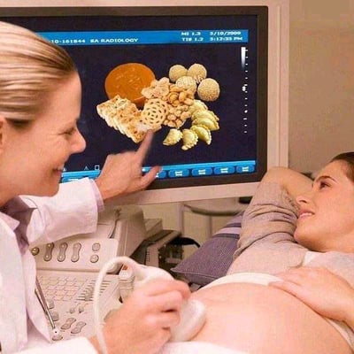 这是一张经过P图改编的搞笑静态图，场景设定在医院的B超检查室。画面左侧是身着白大褂的女B超医生，她手持B超探头放在孕妇的腹部，脸上带着笑容，用手指向面前的B超显示屏；画面右侧是躺在检查床上的孕妇，她面带微笑，正看向B超显示屏。原本应该显示胎儿影像的B超屏幕，被替换成了各种零食的图像，包括不同样式的饼干、意面形状的零食、圆形点心等。这张图用夸张荒诞的方式玩了一个趣味梗，暗示孕妇在孕期嘴馋的念头非常强烈，把对胎儿的B超画面替换成零食，制造出搞笑又贴近生活的效果，容易引发有孕期经历的人群共鸣。