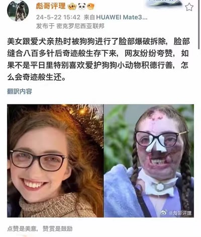 这是一张来自微博的社交媒体截图，属于图文混排的左右对比图。图中左侧是一位戴眼镜的女子面部完好时的微笑照片，状态轻松愉快；右侧是该女子被狗咬伤后的照片，脸部伤痕明显，鼻子处有固定装置，面部经过缝合，状态凄惨。配文编造了“美女跟爱犬亲热时被狗狗进行了脸部爆破拆除，脸部缝合八百多针后奇迹般生存下来，网友纷纷夸赞，如果不是平日里特别喜欢爱护狗狗小动物积德行善，怎么会奇迹般生还”的荒谬言论，强行将被狗咬伤的不幸事件与“积德行善”关联，逻辑扭曲，毫无道理，引发观者的不适与反感。