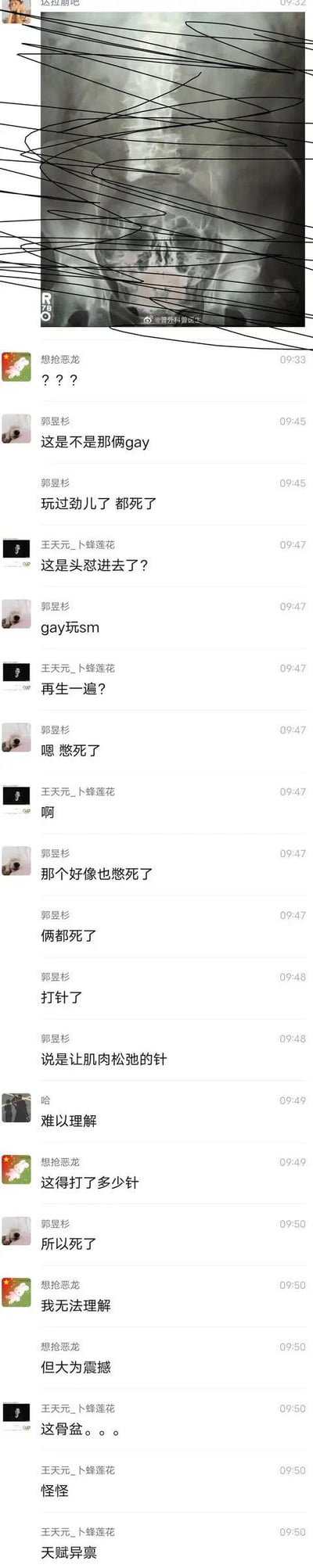 这是一张竖屏的微信聊天群截图，顶部是一张被大面积涂黑遮挡的人体骨盆部位X光片，群内多名成员围绕这张X光片，讨论一起网传的离奇死亡事件：两名男性因使用肌肉松弛针进行特殊私密行为后双双死亡。群成员在对话中猜测事件过程，认为两人是因肌肉松弛针导致窒息死亡，同时表达了对该事件的难以理解、震惊与震撼的情绪，对话内容充满猎奇色彩。