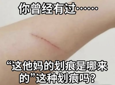 整张图为实拍的人体手臂特写，手臂皮肤上有一道细长的红色浅划痕，图片顶部和底部都加有带黑边描边的白色醒目文字，顶部文字为“你曾经有过……”，底部文字为“‘这他妈的划痕是哪来的’这种划痕吗？”，整体内容调侃了很多人都有过的不知道何时何地被划伤、完全回想不起划痕来源的共同生活经历，很容易引发受众共鸣。