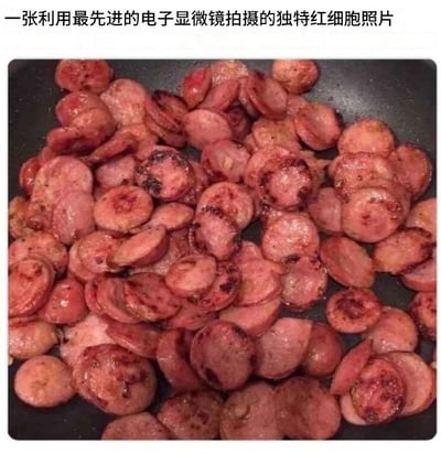图片中展示了一锅煎得通红的香肠片，表面略带焦黑，边缘有些卷曲，整体呈现出圆润的形态。图片上方配有文字“一张利用最先进的电子显微镜拍摄的独特红细胞照片”，通过香肠切片后红色、圆形的外观与显微镜下红细胞形态的相似性制造幽默效果，属于视觉误导类搞笑梗图。
该梗图利用了日常食物与科学图像的形态相似性进行调侃，让观者产生“科学照片”的初步印象，随后发现是普通食物，形成认知反差笑点。