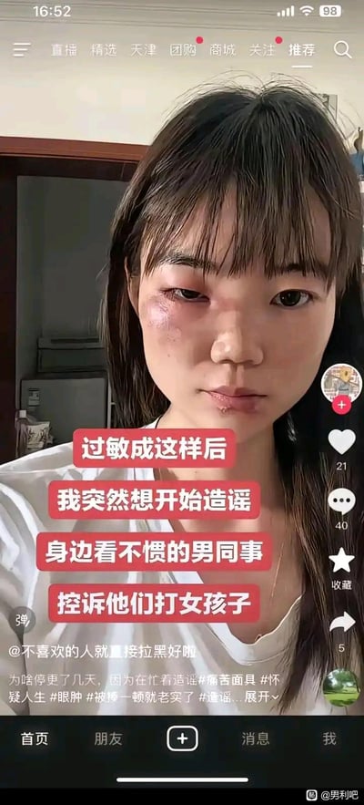社交媒体截图中，一位女性展示自己因过敏导致的面部红肿，配文称想借此造谣看不惯的男同事打女孩子。画面中能看到典型的短视频平台界面，包括点赞、评论、收藏按钮及用户信息。这是一种带有黑色幽默和讽刺意味的表达，用夸张方式吐槽职场人际关系。