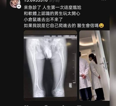 社交媒体截图显示一个尴尬的急诊经历：用户称与线上认识的男生玩耍时，小仓鼠钻进身体无法出来，现已前往急诊。截图包含两张图片：左侧是显示体内仓鼠位置的X光片，右侧是两名穿着白大褂的医生在医院走廊的背影。整个内容以幽默自嘲的方式描述了这个令人尴尬的意外医疗状况。