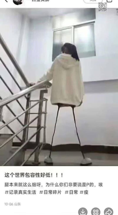 这是一张利用视觉错位制造搞笑效果的生活类梗图：画面中的女生背对着镜头站在楼梯平台，手扶栏杆，她的长款白色毛衣下摆刚好遮挡住真实腿部，楼梯下方的黑色栏杆线条与她脚上的白色拖鞋重合，形成了她拥有两根超细“火柴腿”的错觉。配文以假装委屈的语气吐槽“这个世界包容性好低！！！腿本来就这么细呀，为什么你们非要说是P的，唉”，搭配#记录真实生活 #瘦等话题标签，用一本正经的态度和夸张的视觉效果制造反差搞笑感。