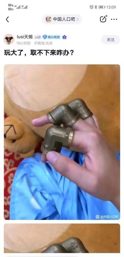 该图是百度贴吧“中国人口吧”的用户发帖截图，发帖用户为ID“lusi天蝎”的核心吧友，IP属地北京，发帖时间为截图前18小时，配文“玩大了，取不下来咋办？”。配图显示一只手的三根手指分别套入了三个L型铜质水管接头内，手指被卡住无法取出，背景可见毛绒玩偶、蓝色布料与木质桌面。