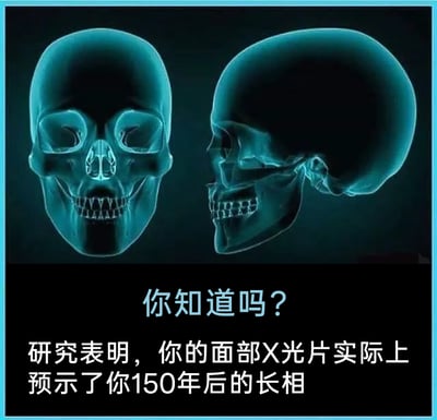 这是一张采用顶配底文形式的静态趣味图片，上方展示了两幅3D渲染的人类面部X光影像，分别为正面和侧面视角，清晰呈现出颅骨、牙齿的完整骨骼结构；下方以“你知道吗？”的提问式开头，引出一段带有调侃性质的“研究结论”，称面部X光片预示了人150年后的长相，本质是用幽默的方式调侃生命的最终形态，是一个没有真实学术依据的网络趣味梗图，通过反差感制造笑点。