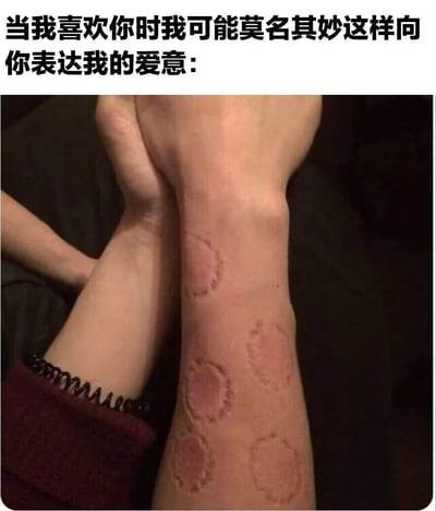 图片上方配有文字“当我喜欢你时我可能莫名其妙这样向你表达我的爱意：”，下方是两只手臂的特写，其中一只手臂上有多个圆形的红色印记，疑似吻痕（hickey）。整体通过幽默的方式表现喜欢一个人时可能会用比较特别或让人困惑的方式表达爱意，带有调侃和搞笑的意味。