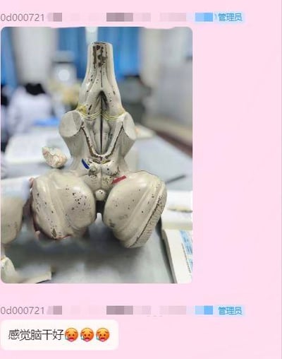 这是一张即时通讯平台的聊天记录截图，用户发送了一张外观干燥陈旧的脑干解剖模型照片，配文“感觉脑干干好😫😫😫”，玩了谐音梗：将“脑干挺好”谐音为“脑干干好”，既对应了模型干燥的外观，又搭配无奈表情传递出疲惫、自嘲的情绪，大概率是医学生群体用来调侃学业压力或自身不佳的精神状态。