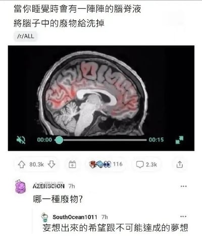 这是一张Reddit社区的帖子截图，顶部首先科普了人体知识：人在睡觉时脑脊液会不断清洗大脑里的废物，下方搭配了一段时长15秒的脑部核磁共振成像视频的截图。帖子下有网友提问「哪一种废物？」，另一名网友给出了扎心又带有调侃性质的回复「妄想出来的希望跟不可能达成的梦想」，将原本普通的科普内容玩梗成丧文化相关的搞笑内容，反差感十足。