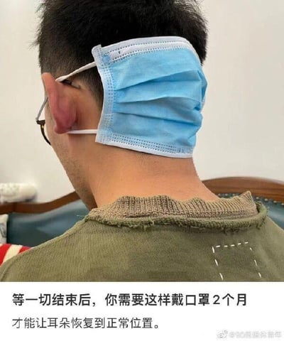 这是一张搞笑的改图作品，图中展示了一位男性的背影，他的耳朵因为长期佩戴口罩被勒得移位到了靠近后脑勺的位置，他将蓝色医用口罩反向佩戴，口罩主体罩在后颈处，挂绳依旧挂在变形的耳朵上。图片下方配有文字：“等一切结束后，你需要这样戴口罩2个月才能让耳朵恢复到正常位置。” 这是通过夸张的P图和配文，调侃长期佩戴口罩导致耳朵被勒的困扰，用反向戴口罩的荒诞方式来制造笑点，没有双关、谐音梗等内容。
