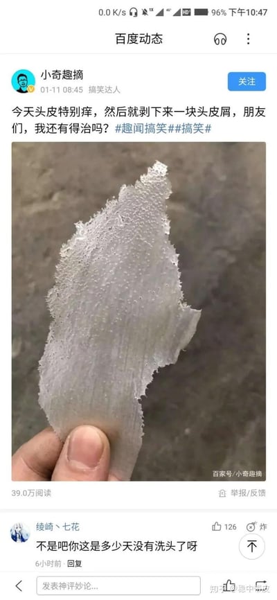 这是百度动态用户「小奇趣摘」发布的搞笑整活内容，配文称自己头皮发痒，剥下了一块巨大的头皮屑，实际配图是一块类似笋壳的片状物，伪装成超大头皮屑来制造夸张的搞笑效果。评论区有用户调侃「不是吧你这是多少天没有洗头了呀」，该内容获得了39.0万阅读量，通过虚假的夸张内容吸引眼球，制造网络笑点。