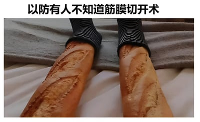 图片上方配有文字“以防有人不知道筋膜切开术”，下方主体为两根法棍面包，其顶部套着黑色条纹袖套，整体造型酷似人的腿部。法棍表面自然形成的长条裂纹被幽默地类比为“筋膜切开术”的手术切口，通过视觉联想制造出搞笑效果，属于谐音梗与实物类比结合的幽默创作。