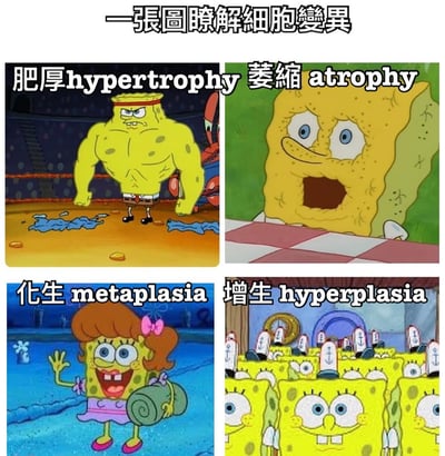 这是一张四格拼接的科普梗图，通过《海绵宝宝》动画角色的不同造型幽默解释细胞变异的四种类型。左上格：肌肉发达、表情严肃的海绵宝宝，配文“肥厚 hypertrophy”；右上格：身体干瘪萎缩、表情惊讶的海绵宝宝，配文“萎缩 atrophy”；左下格：穿着粉色裙子、扎着蝴蝶结的女装海绵宝宝挥手，配文“化生 metaplasia”；右下格：大量 identical 的海绵宝宝整齐排列，配文“增生 hyperplasia”。整体用卡通形象将抽象的医学概念可视化，风格轻松有趣。