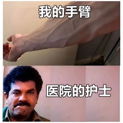 图片为上下拼接的对比图。上半部分是一只手臂的特写，上方配有文字“我的手臂”；下半部分是一位男性的面部特写，右侧配有文字“医院的护士”。通过上下两部分的内容对比，形成一种幽默的视觉效果，可能用于调侃或表达某种情境下的反差感。