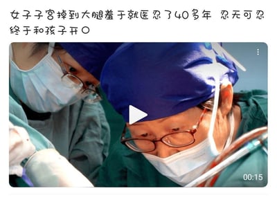 图片上方文字描述“女子子宫掉到大腿羞于就医忍了40多年 忍无可忍终于和孩子开O”，下方为手术场景截图，显示两位戴蓝色手术帽和口罩的医生正在专注进行手术操作，画面中央有视频播放按钮，右下角显示时长00:15。文字内容存在低俗暗示，“开O”可能为不恰当表述，涉嫌对医疗事件的低俗化处理。
