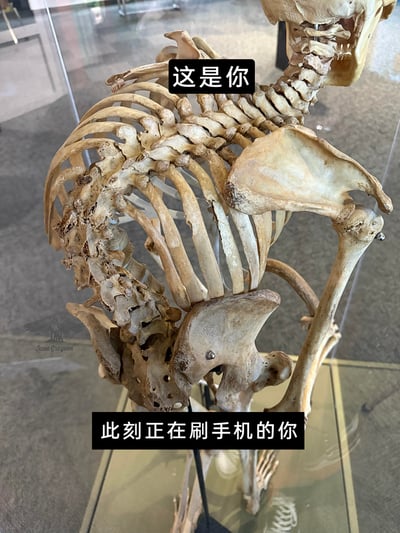 这是一张带有调侃性质的文字加注静态图，画面主体是一具脊柱严重弯曲变形的骨骼标本，标本的脊柱上方标注了文字“这是你”，图片下方标注了“此刻正在刷手机的你”。该图通过夸张的骨骼形态，幽默地调侃长期低头刷手机的人群可能出现的脊柱变形问题，以趣味化的方式提醒人们注意长期低头使用电子设备的不良姿势对脊椎健康的影响，引发人们对自身日常习惯的关注。