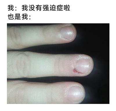 这是一张用来自嘲强迫症的趣味梗图，上方分为两段文字，第一段是“我：我没有强迫症啦”，第二段是“也是我：”，下方搭配了一张三根手指的特写图，其中中间手指的指甲侧边有明显的破损和出血痕迹，看起来像是因为无法控制自己反复抠咬指甲周围皮肤的强迫症行为所造成的。通过嘴上否认和实际行为的强烈反差，生动又幽默地调侃了部分强迫症患者嘴硬却控制不住自己的真实状态，容易引发有类似经历的网友共鸣。